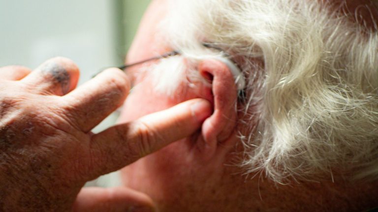 Bourdonnement oreille et AVC
