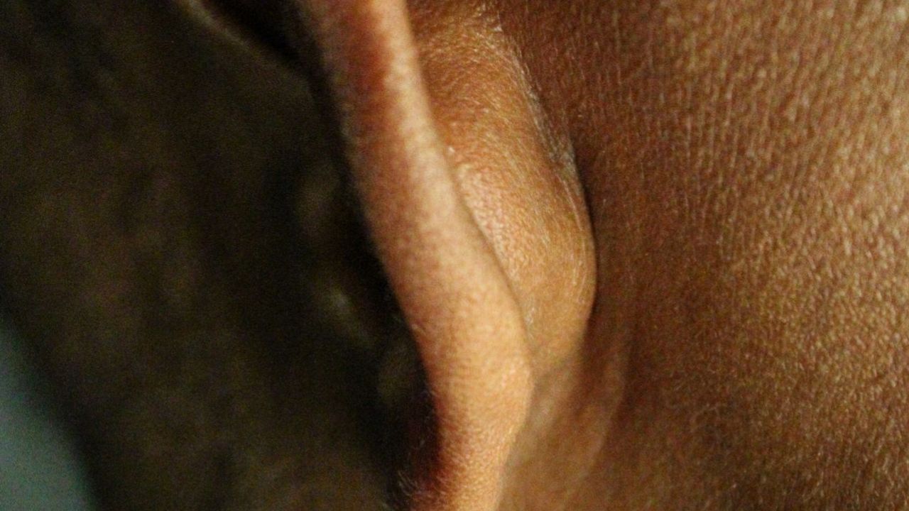 Boule derrière l’oreille